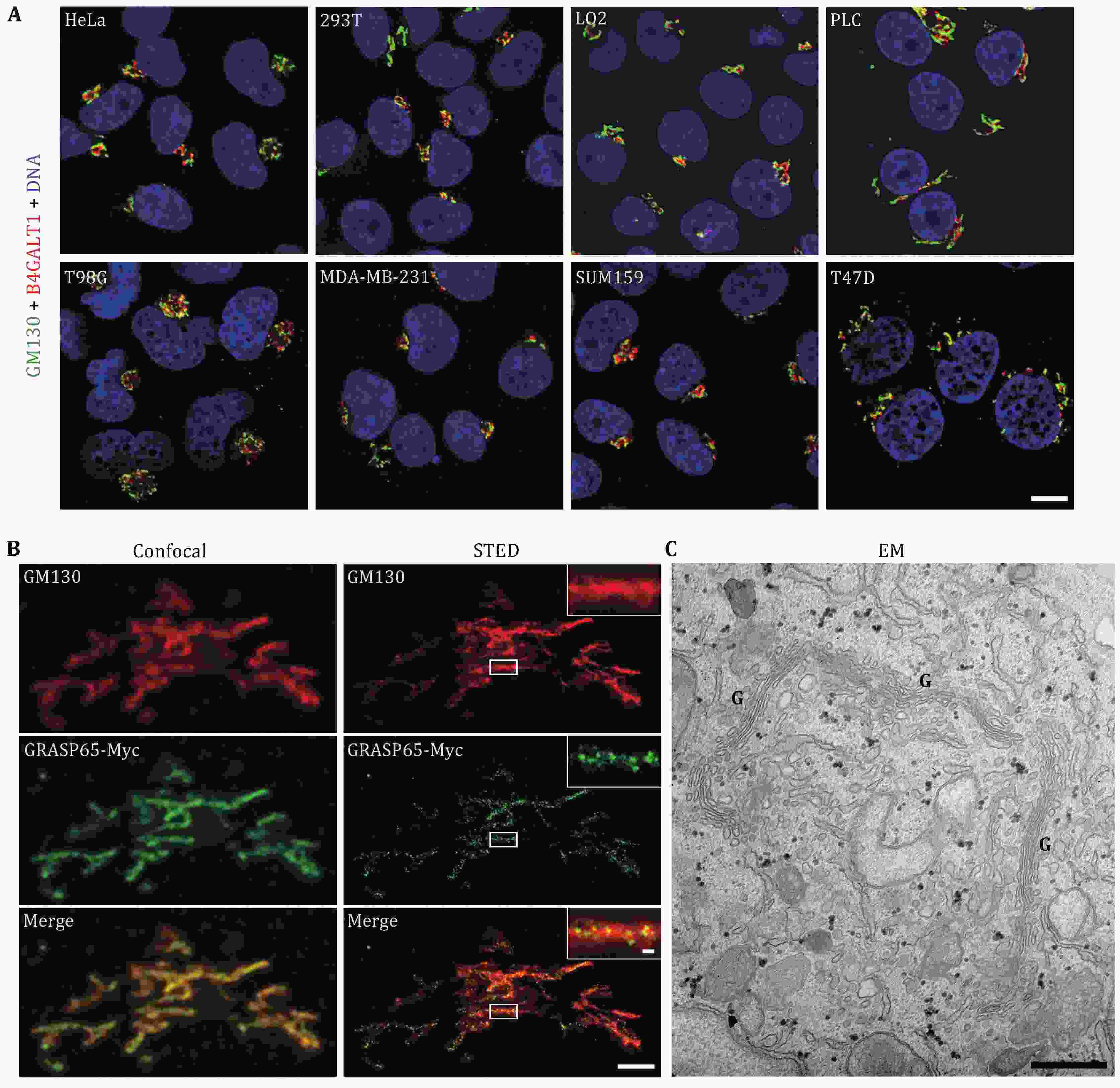 Morphological determination of localization and function of Golgi proteins