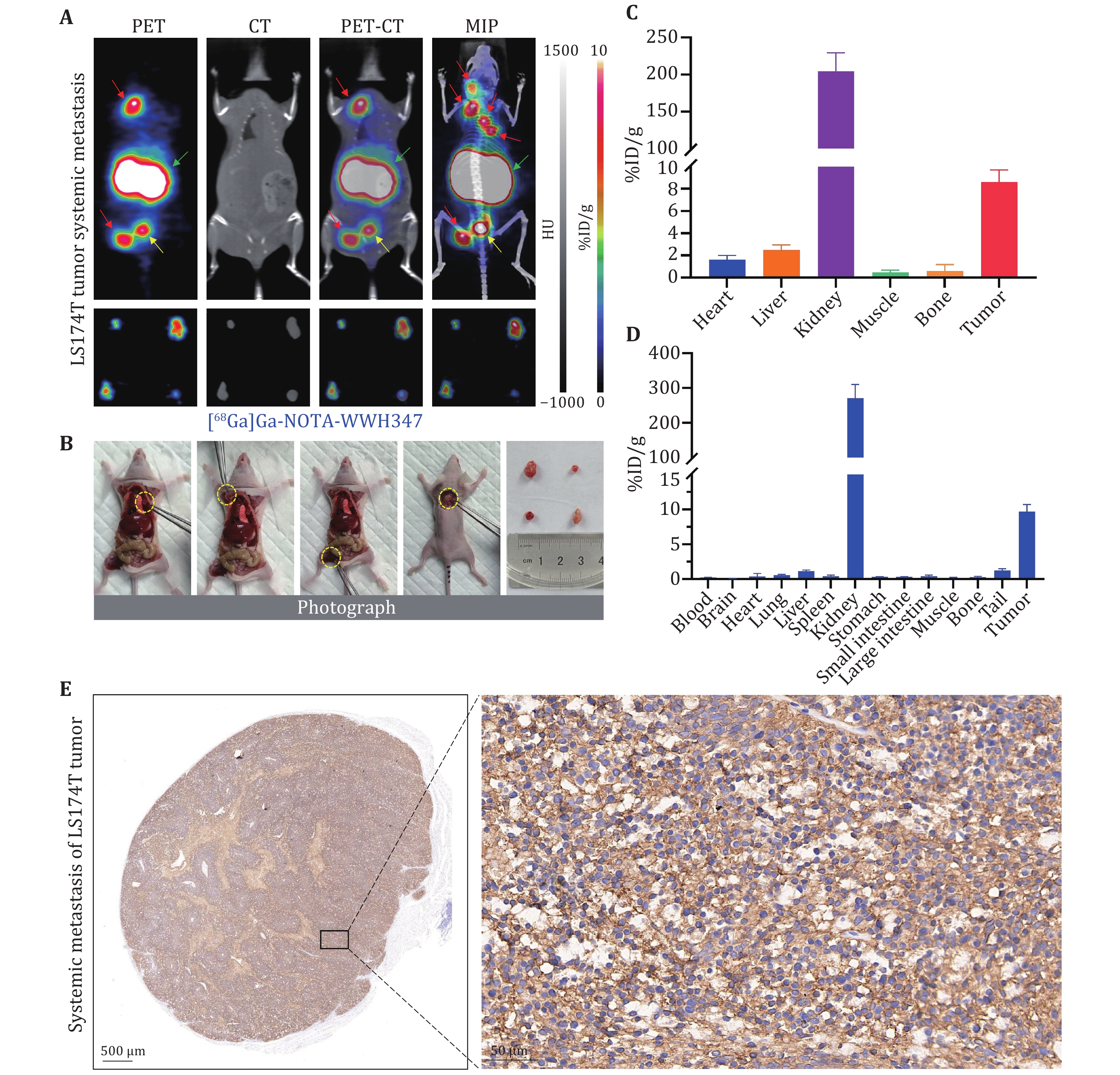 Tumor ImmunoPET/CT imaging with [68Ga]Ga-NOTA-WWH347 in systemic